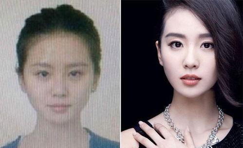 明星带牙套前后对比照,牙套助力颜值大逆袭